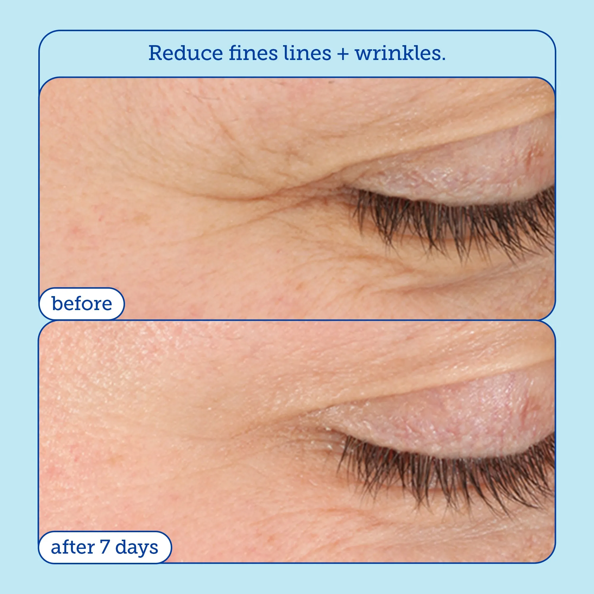 Barrier  (Refill) Triple Lipid-Boost 360° Eye