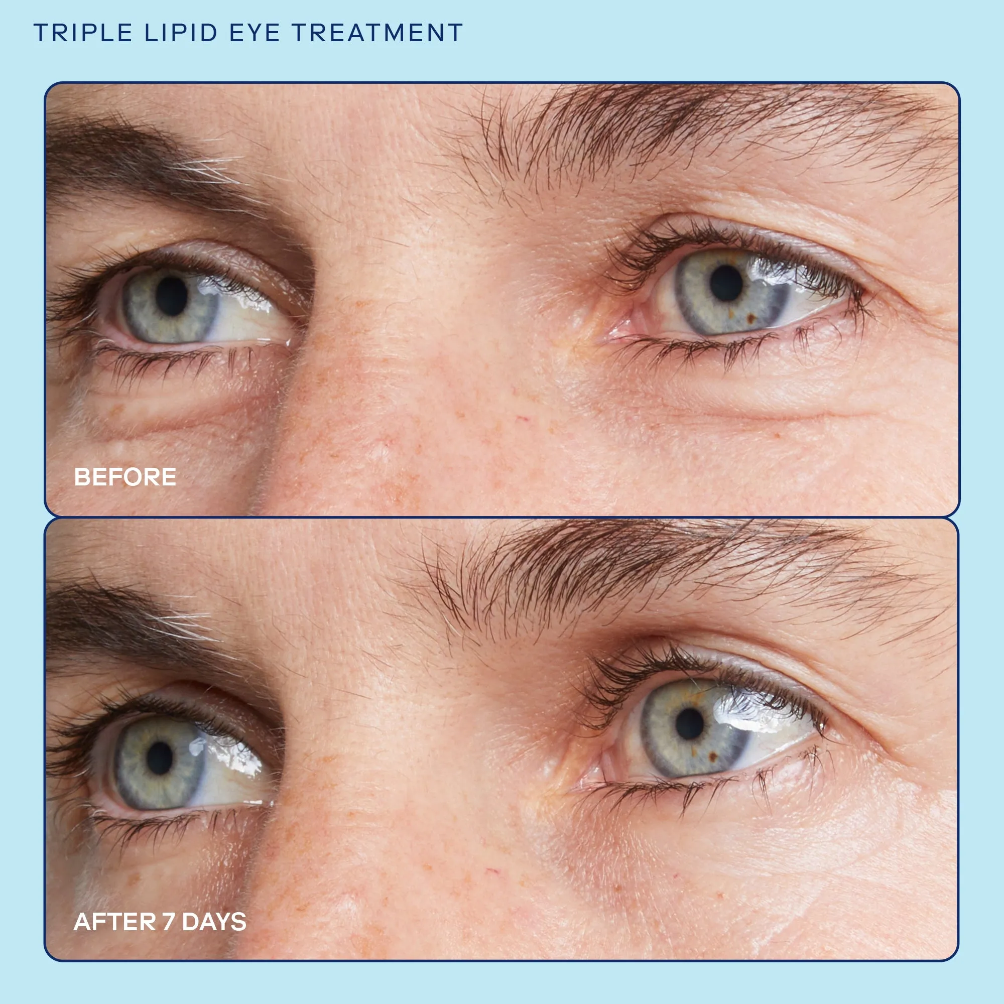 Barrier  Triple Lipid Eye Treatment