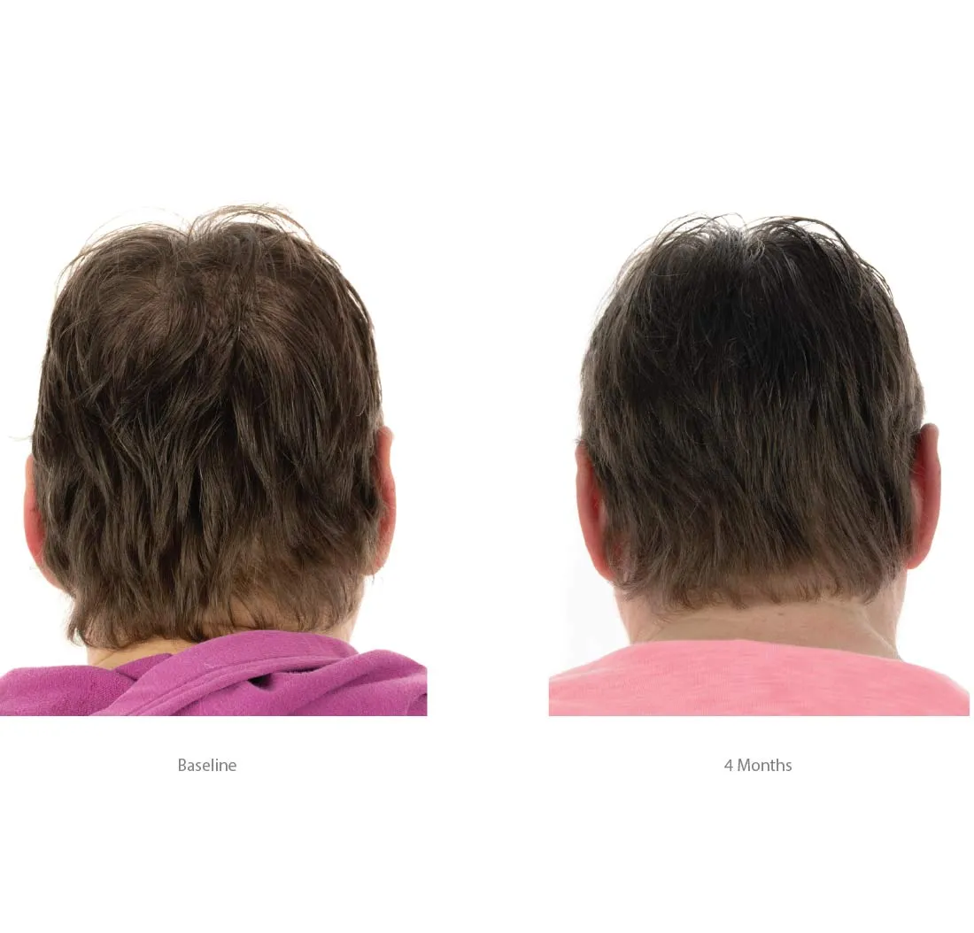 FOLIGAIN Hair Growth Shampoo   Conditioner Kit For Women