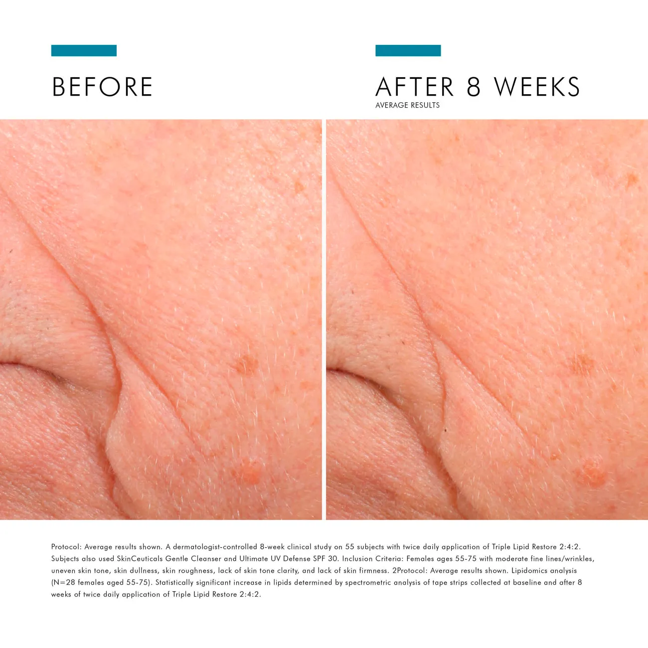 Triple Lipid Restore 2:4:2